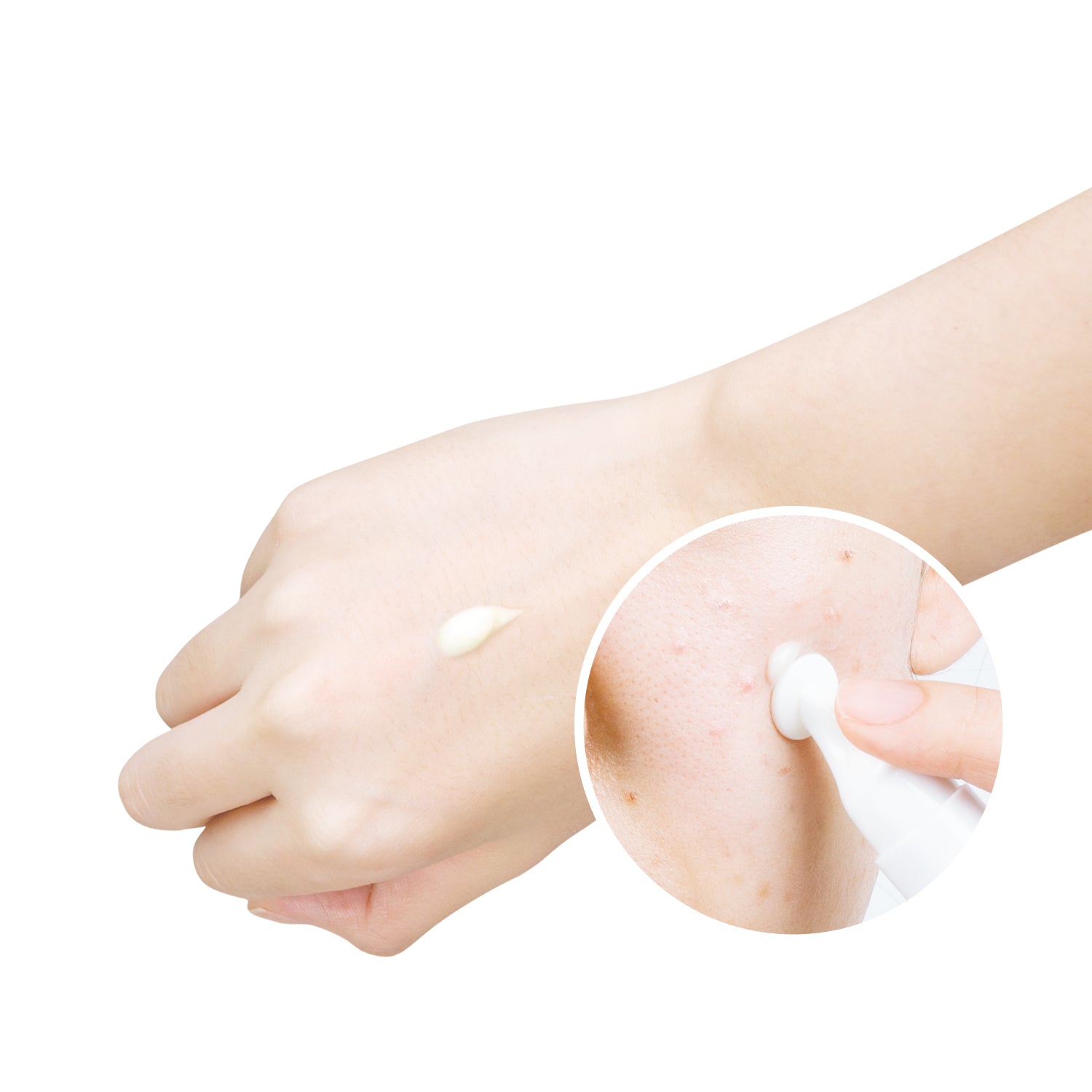 YADAH Anti-T Red Zero Spot Cream